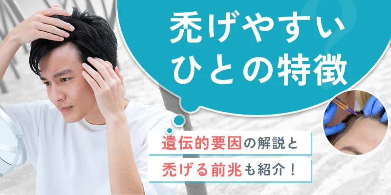 禿げやすい人の特徴と禿げる前兆とは?セルフチェックや対策も紹介