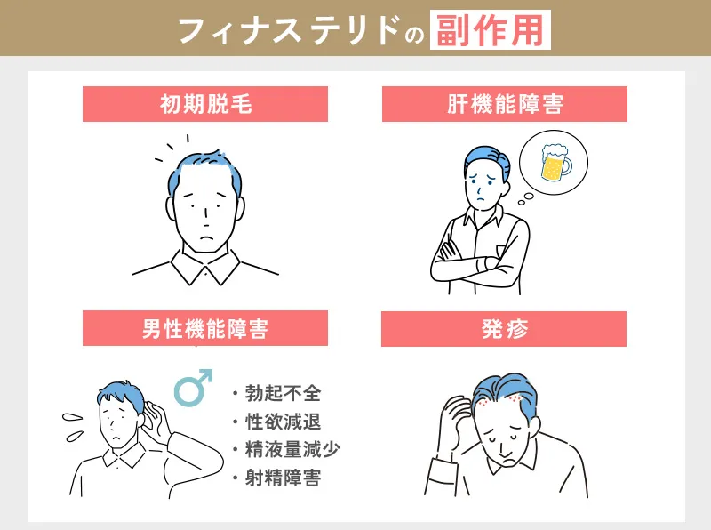 フィナステリドの副作用