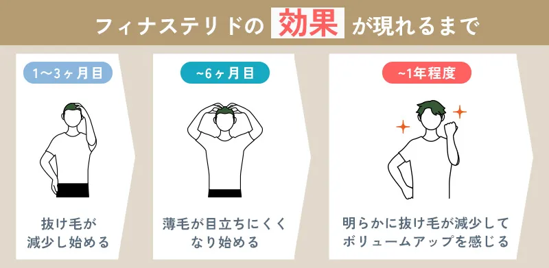 フィナステリドでAGA治療の効果を実感するまでの目安期間