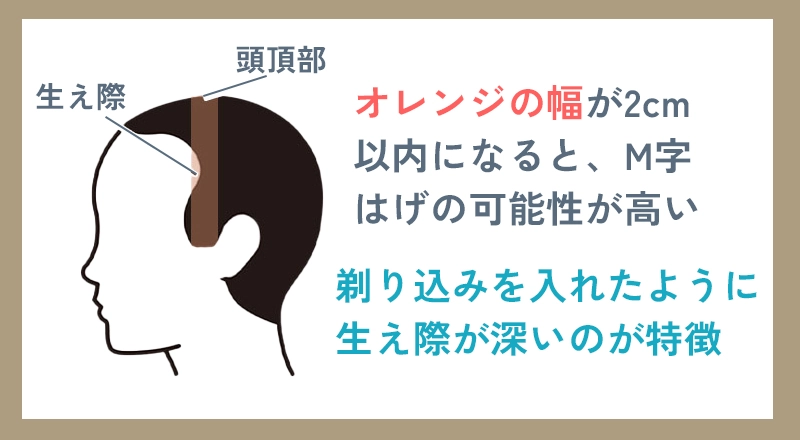 生え際が後退しているか確認する方法