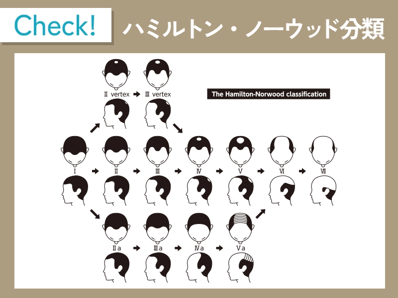 ハミルトンノーウッド