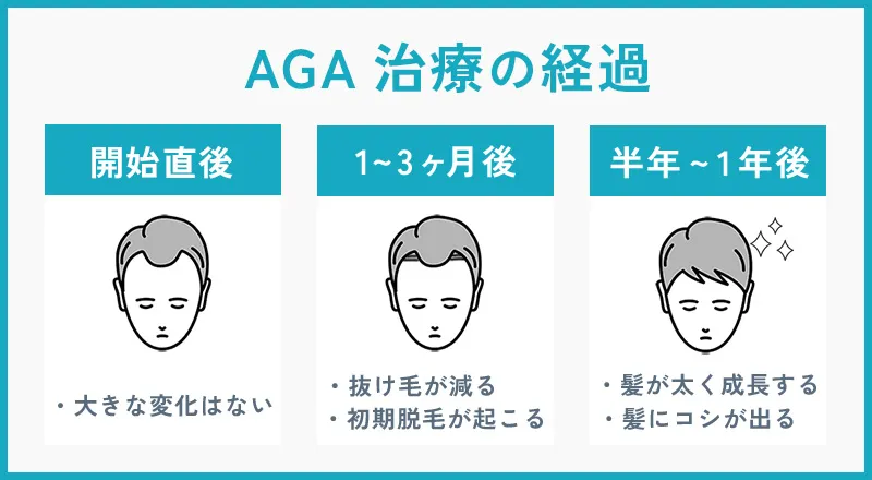 AGA治療の期間と治療の経過