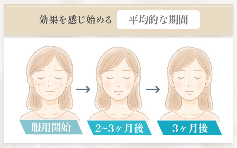 ピルによるニキビ改善の効果を感じ始める平均的な期間