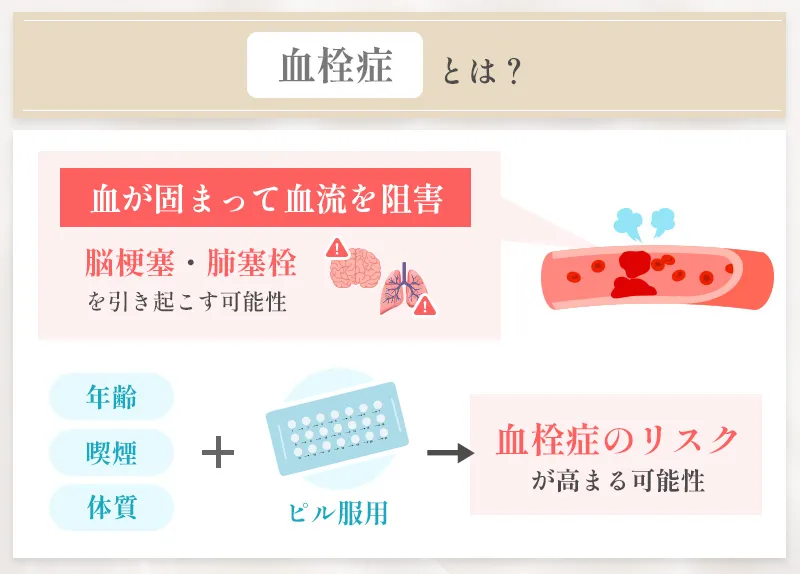 血栓症とは血が固まって血流を阻害する症状