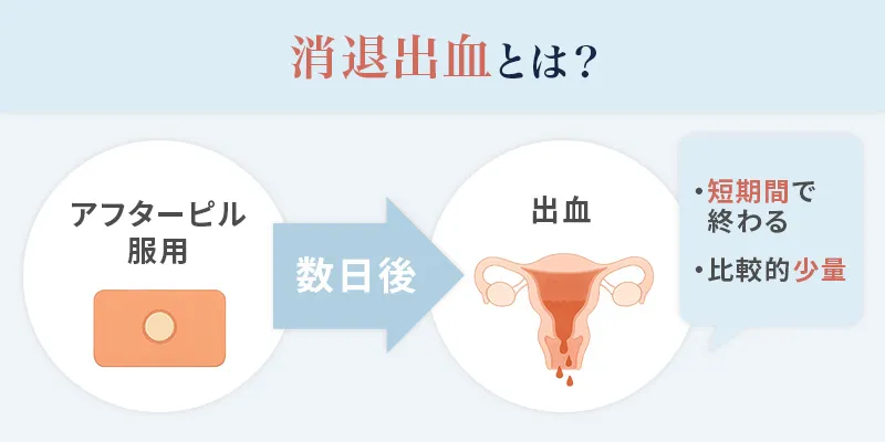 アフターピルフキ用語の消退出血とは何か