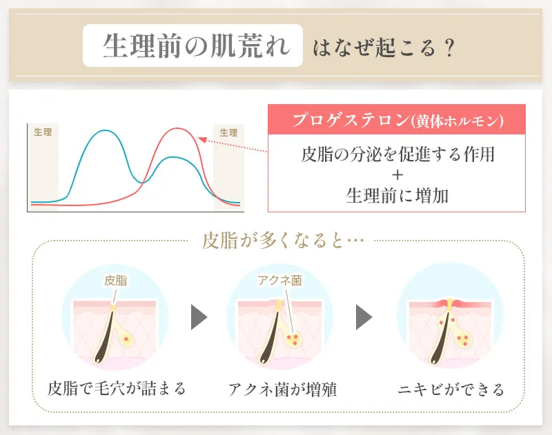 生理前の肌荒れはなぜ起こるのか