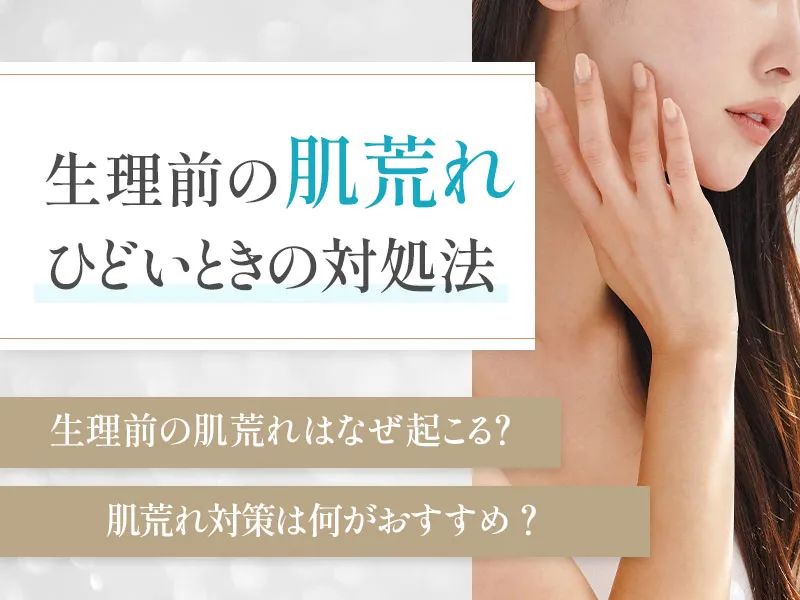 生理前の肌荒れがひどい理由とは!スキンケアや薬による対策を紹介